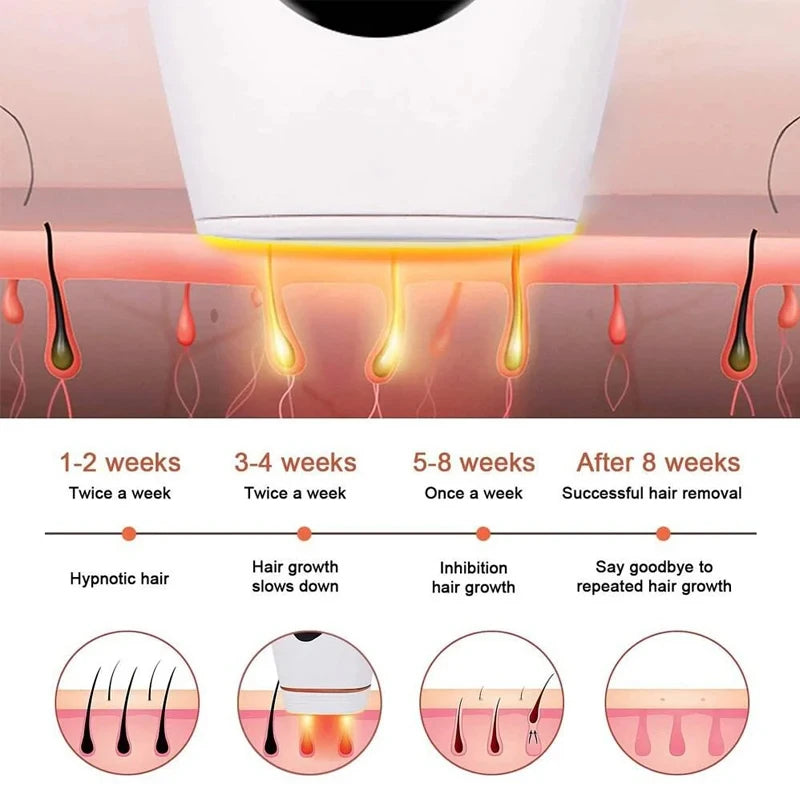 10  Beauty Care IPL Hair Removal Device 990000 Flashes Painless Permanent for Women Face Body Bikini LED Display Home Use