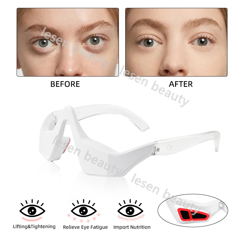 3D Beauty Eye Device with Microcurrent Eye Relaxation Reduce Wrinkles and Dark Circles Eliminate Edema Mass Portable skin care v